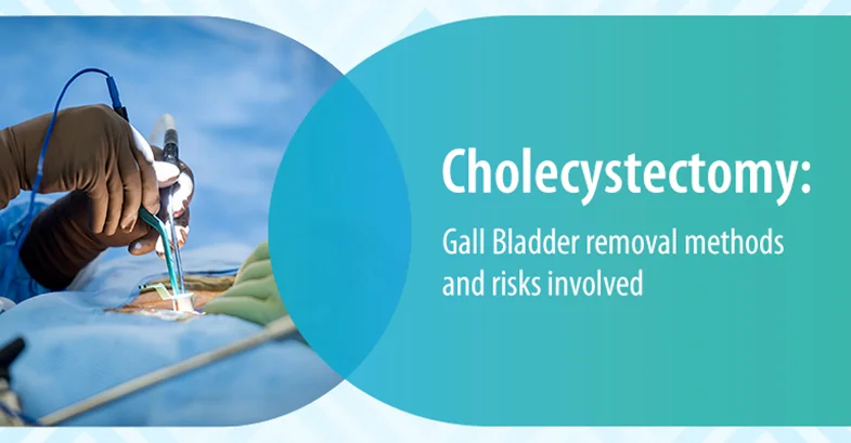 Cholecystectomy: Gall Bladder removal methods and risks involved