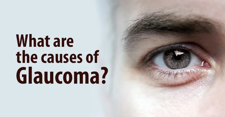 Glaucoma: Causes & Impact