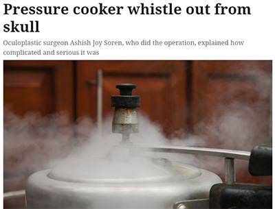 Doctors Remove Pressure Cooker